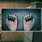 Colored nails with a rash on Basement Teenager