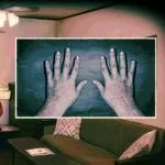 Rash hands on a Visitor