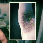 Naked Guy Visitor armpit fungus
