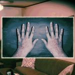 Rash on hands of Woman with a Kid as a Visitor sign