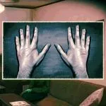 Wounded Man's scratched up hands